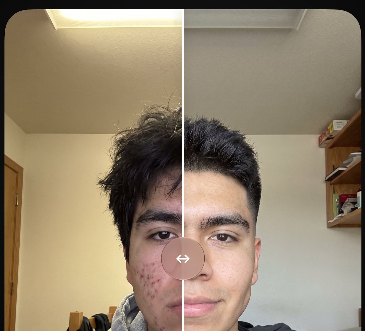 Before and after example, 4.2 to 7.5